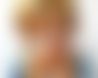 Virus Sincicial Respiratorio (VSR)