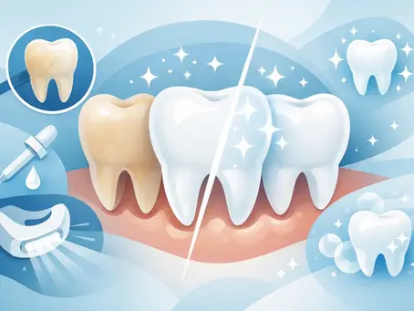 How Does Teeth Whitening Work?