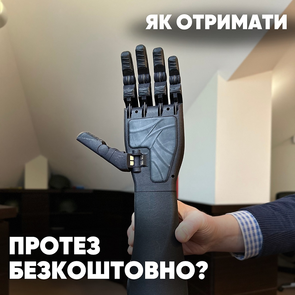 Як отримати біонічний протез
