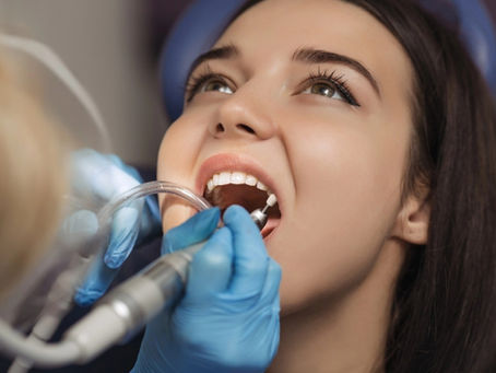Dentist polishing patient teeth at the dental office.