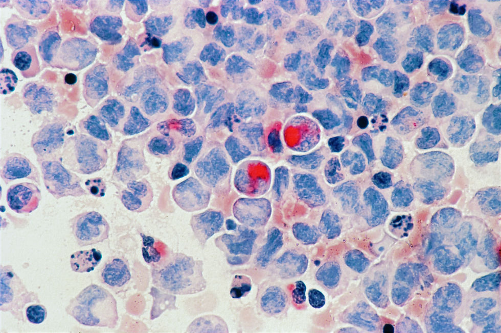 national-cancer-institute-mbL91Lg56zc-unsplash_edited_edited.jpg