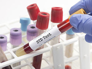 std test.jpeg
