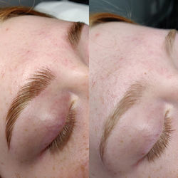 Brow Lift  ~milla