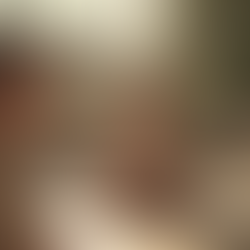 Top Strategies for Supporting Anxious Kids' Growth