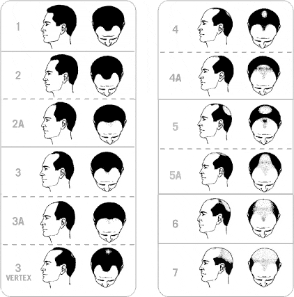 脱毛2.gif