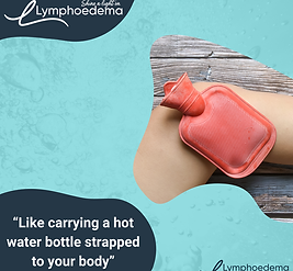 Lymphoedema 01.png