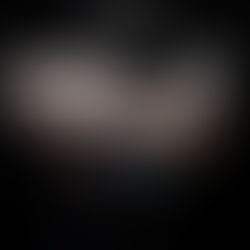 The update #1 - 22/03/26