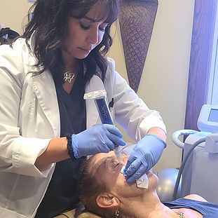 Microneedling Treatment