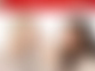 Dissolve Jaw and Chin Fat with Kybella