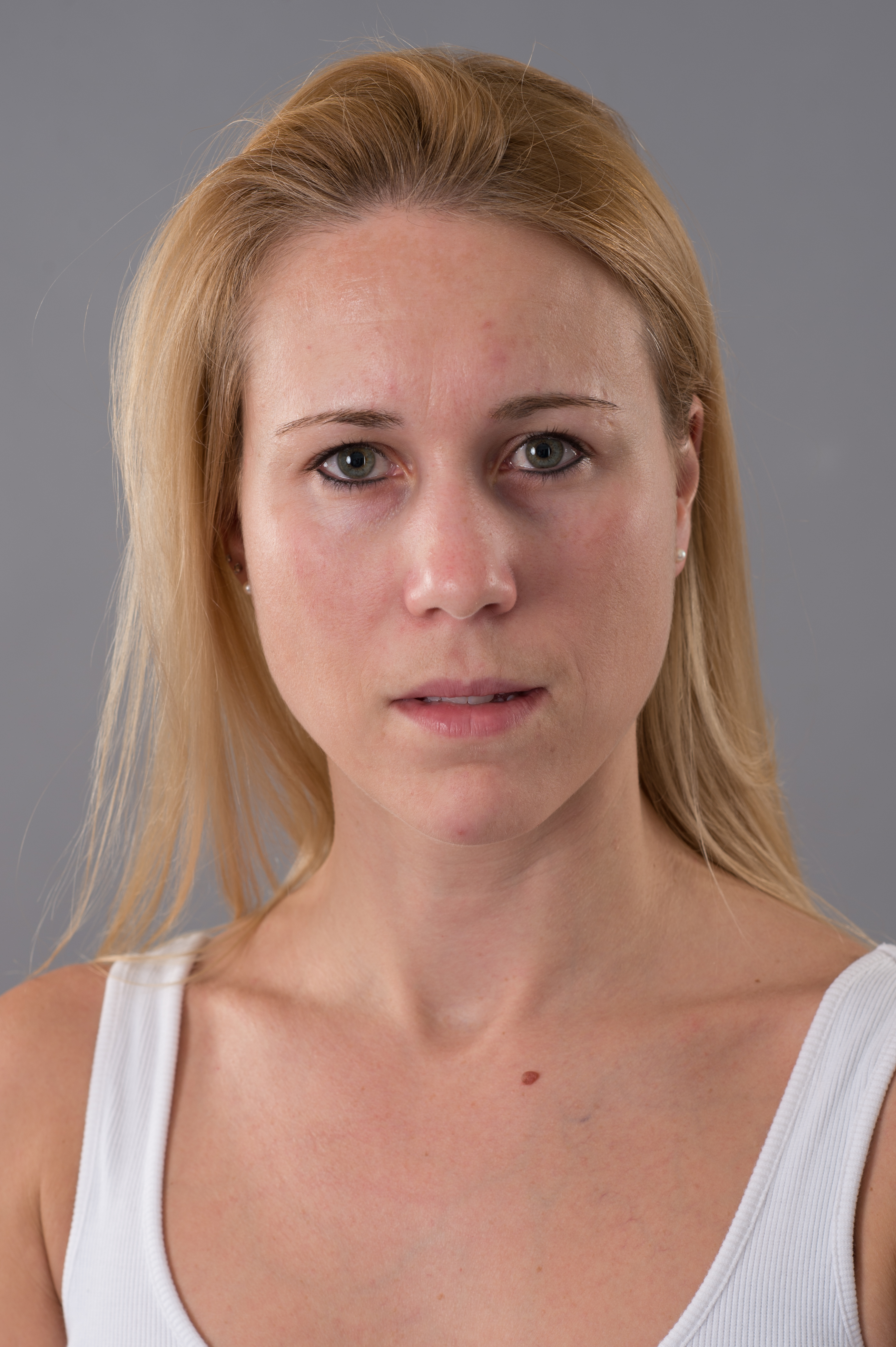 Vorher