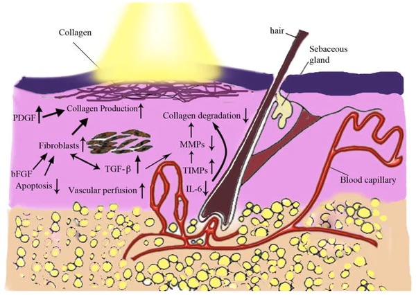 light therapy
