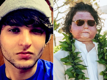 New Jersey Man Who Survived Fiery Crash and Underwent Historic Face and Hand Transplant Shares Inspiring Journey
