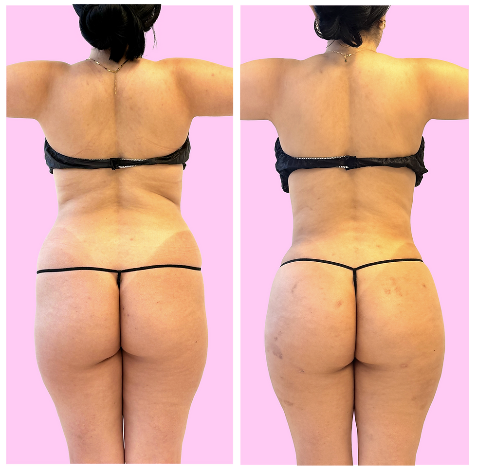 web before and afters-05.png