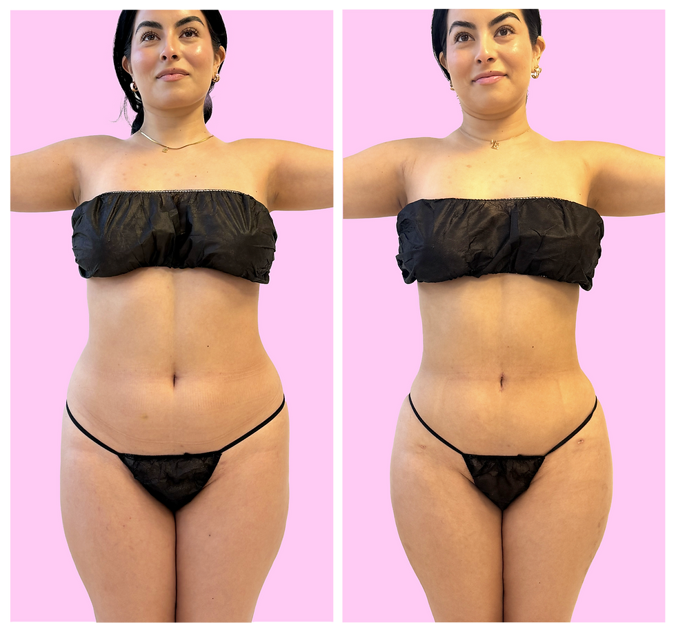 web before and afters-04.png