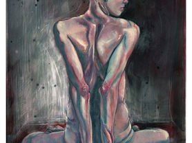 Hypermobility works-in-progress