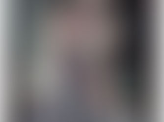 Hypermobility works-in-progress