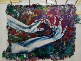 Work in Progress — Hypermobility