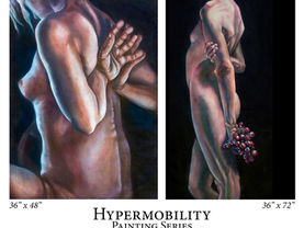 Grant Awarded for 'Hypermobility' Series