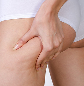 CELLULITE.jpeg