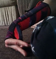 A red and purple Lycra glove on Ailsa’s hand and forearm. Space-theme purple reinforced material to encourage Ailsa’s muscles to be in the right position. The glove goes down to Ailsa’s knuckles and up to just below her elbow.