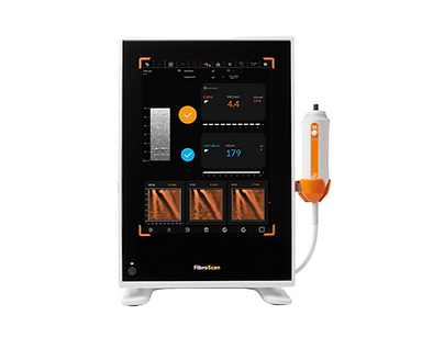 FibroScan Compact 530