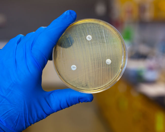 ¿SON OBLIGATORIAS LAS ANALÍTICAS?