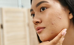 young asian woman with brunette hair and acne prone skin looking at mirror in bathroom, ba