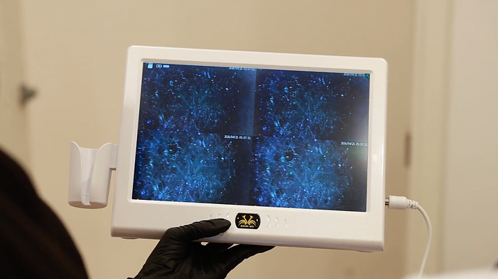 Scalp Scan