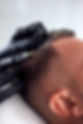 Hair Restoration.jpeg