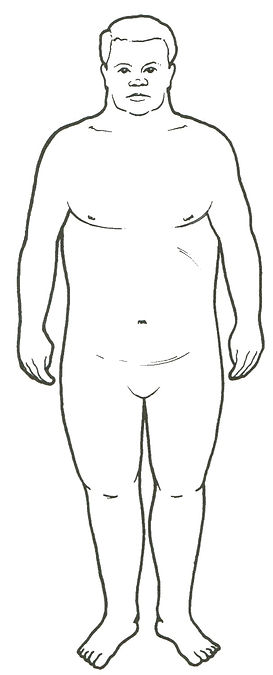 Endomorf – jord