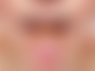 La importancia de limpiarse la lengua todos los días