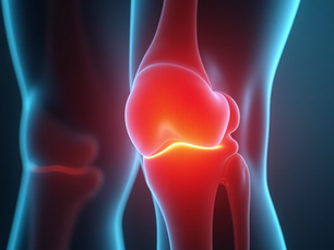 Wegovy and Arthritis: Can Weight Loss Drugs Help Reduce Joint Inflammation?