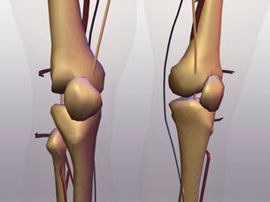Preparation for surgery: are you ready for a knee or hip replacement?
