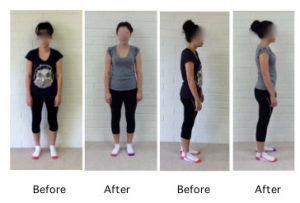Pictures of young woman before and after treatment of her chronic pain