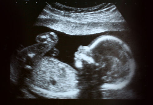 ultrasound2.jpg