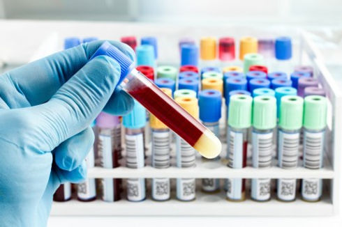 bloodtestTubescrop-466x310.jpg