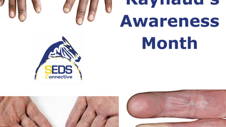 Red, White and Blue are my digits you know? February is Raynaud’s Awareness month