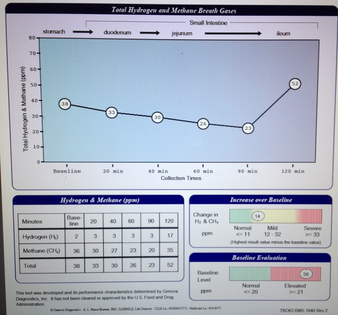 My lactulose breath test: results. | Sexy Sibo