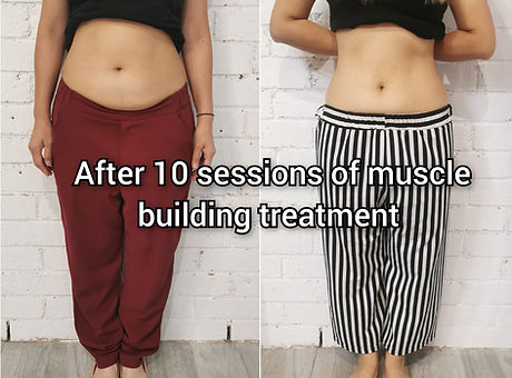 Brazilian butt lift, Fat burning, Muscle building, core strength, stomach slimming, sit ups, planks, core workoutMuscle separation, Diastasis recti, Core workout, ab workout, abdominal workout, muscle separation, muscle tightening, skin tightening, skin firming, stomach lift, butt lift, non surgical tummy tuck, tummy lift, mummy tummy, stomach sagging, mummy pouch, mummy tummy, weight loss