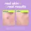Thumbnail: Breakout Clearing Liquid Peel