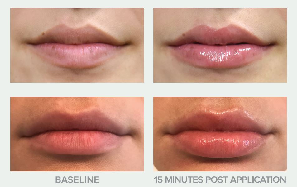 Thumbnail: Perfect Pout Lip Plumper