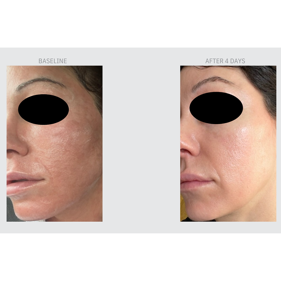 Thumbnail: Brightening and Toning Corrector
