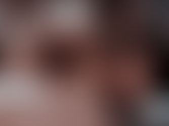 Transform Your Smile with Botox®