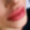 Lip Flip Special HD Medical & Aesthetics.webp
