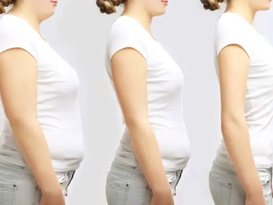 Woman loosing weight through medically supervised weight management