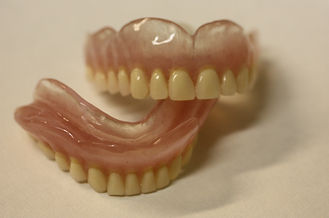 dental implant