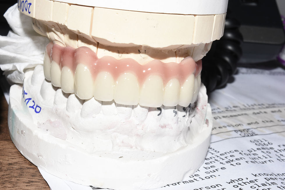 Dental implant Bridge