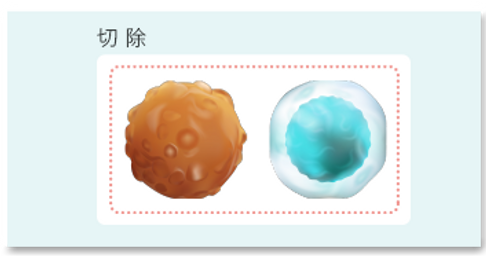 がん免疫療法 手術.png