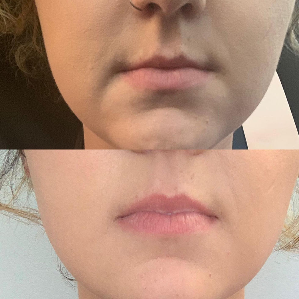 0A177848-C492-4DFA-9EA7-7643231E7026