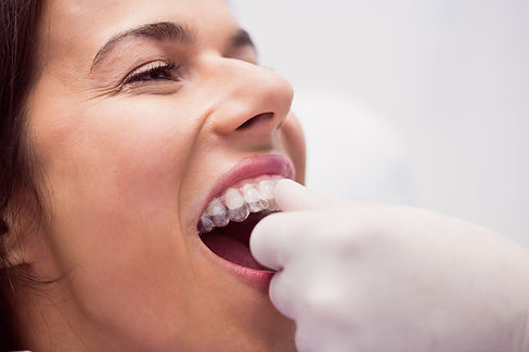 dentista-ajudando-o-paciente-do-sexo-feminino-a-usar-aparelho_edited.jpg